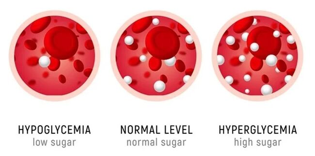 Ang SugaNorm gipakita alang sa tanan nga mga porma sa diabetes